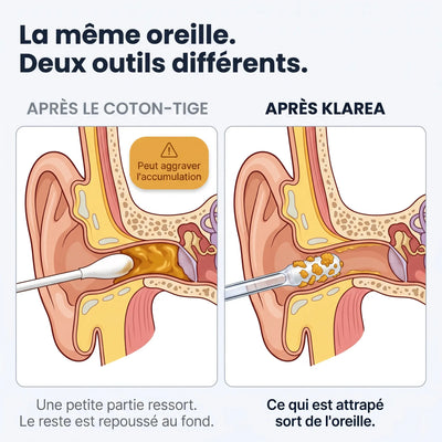 Klarea Pro® Nettoyeur d'oreille adhésif